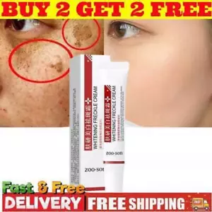 Whitening Freckle Cream Remove Dark Spots Anti Freckle Cream Niacinamide Fade - Picture 1 of 11