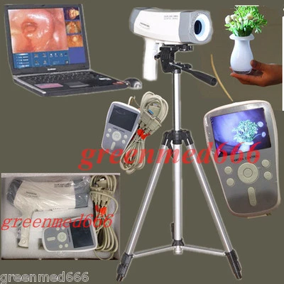 Colposcopio eléctrico CE video Carema 800.000 píxeles color mango LED + trípode Foto 1 de 4