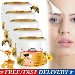 1-5x Bee Venom Skin Tag Removal Treatment Cream Body Care Mole Corn Wart Remover - Picture 1 of 20