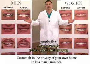 MEDIUM SIZE VENEERS INSTANT SMILE BEAUTIFUL PERFECT TEETH dentures MAKEOVER NEW - Picture 1 of 1