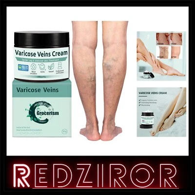 Krampfadern Creme 50g Natürliche Inhaltsstoffe Schmerzlinderung Verbesserung ...