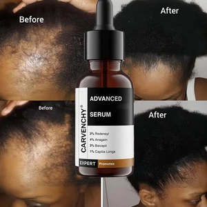 Bare Anatomy Advanced Hair Growth Serum 30 ml H OT C7E4 - Picture 1 of 12