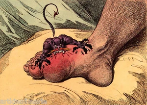 JAMES GILLRAY THE GOUT CARICATURE ART GICLEE PRINT FINE CANVAS - Picture 1 of 4
