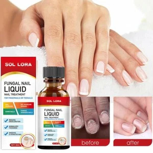 Essence Oil Nail Fungus Killer Toes Fungus Treatment Onychomycosis Removals Best - Picture 1 of 10