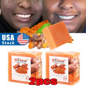 2X Tumeric Soap Skin Whitening Dark Spots lightening Acne Brightening Turmeric - Picture 1 of 18