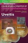 Uveitis: Color Atlas and Synopsis of Clinical Ophthalmology by Sunir J. Garg (En