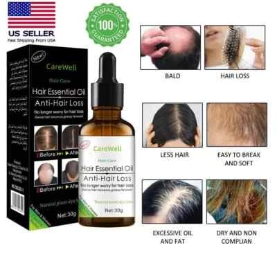Organic Hair Essential Oil Growth Essence Anti Hair Loss All Natural treatment - Image 1 of 4