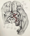 Vintage Ephemera Illustrated Diagram Brain Arteries Medical Anatomy Office Decor