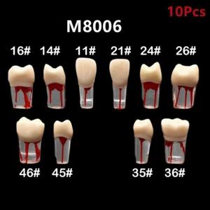 10 piezas Modelo dental dental Bloqueo del conducto radicular endodóntico Estudio Práctica Endo Entrenamiento - Imagen 1 de 27