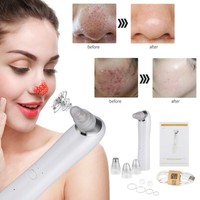 upelix vacuum facial pore cleaner