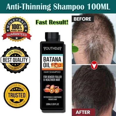 Hair Strengthening Shampoo 100ml - Anti-hair Loss and Solidification Hair - Image 1 of 4
