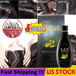 Scalp Hair Follicle Shampoo Antibacterial Anti-Itching Mites Oil Control 200ML - Picture 1 of 18