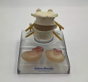 Somso QS68/3 modelo de hernia central y dorsolateral de disco intervertebral lumbar - Imagen 1 de 9