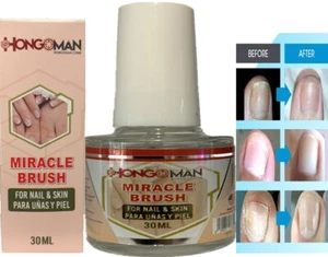 Nail Fungal Support - Nail Fungal fungi BOX hongosan corp original athletes foot - Picture 1 of 6