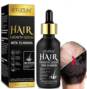 1 kits de crecimiento de cabello y barba de Minoxidil al 5% Tratamiento para el - Picture 1 of 9