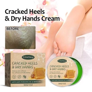 Woodsleep Anti Trockenheit Risse Hand Fuß Pflege Creme Haut Feuchtigkeitsspendend - Bild 1 von 6