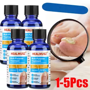 5/3PCS Nail Repair Serum Fungal Nail Treatment Remove Toe Nail Fungus Essence - Picture 1 of 20