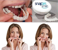 Snap-On Smile Braces