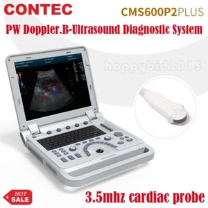 CMS600P2PLUS B-Ultraschallscanner-Diagnosesystem Herzsonde, PW-Doppler - Bild 1 von 13