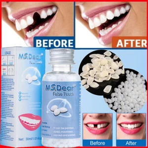 Tooth Repair Granules Temporary Kit Fitting Beads Reusable Moldable False Teeth - Picture 1 of 23