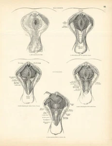 Anatomy. Male Perineum 1880 old antique vintage print picture - Picture 1 of 1