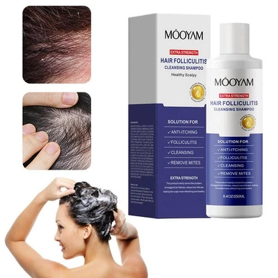 1/2/3X Anti-Fungal Shampoo For Folliculitis, Seborrheic, 8.4Oz 250mL / G0X3 - Image 1 of 4