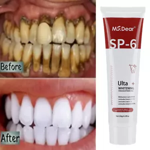 SP-6 Probiotic Whitening Toothpaste Quick White Toothpaste & Keeps Fresh 120g - Picture 1 of 15
