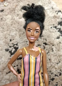 Mattel GHW51 Barbie Fashionistas Doll with Vitiligo and Curly Brunette Hair - Picture 1 of 3