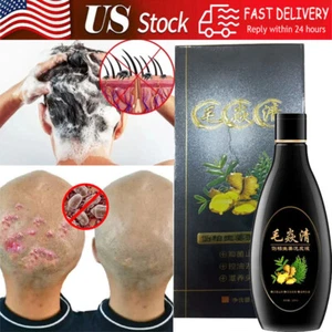 Scalp Hair Follicle Shampoo Antibacterial Anti-Itching Mites Oil Control New USA - Picture 1 of 14