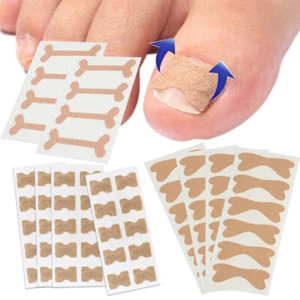 5/4/10pcs Glue Free Toenail Toe Ingrown Nail Correction Patch Nail Sticker j - Picture 1 of 14