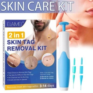 2in1 Wart Remover Kit Wart Papillomas Skin Tag Remover Painless Remover - Picture 1 of 11