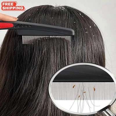 Lice & Dandruff Comb - Fine Tooth, Stainless Steel Hair Care! - Image 1 of 4