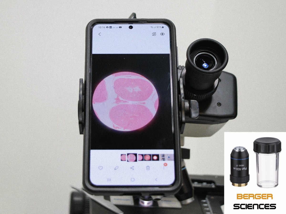 Digiscope Adapter Celticbird Microscope Smartphone Camera Adapter ...