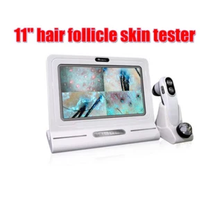 2025 Portátil Portátil Piel Cuero Cabelludo Detector Analizador de Diagnóstico de Cabello Máquina Inteligente - Imagen 1 de 10