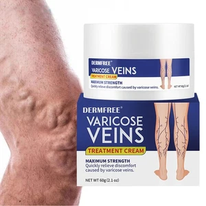 Tratamiento Piernas Venas Varicosas Crema Cuidado de Venas Crema Desvaneciente Pomada Herbal 60g - Imagen 1 de 24