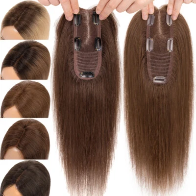 头皮线覆盖礼帽女真人头马人发发际线稀疏 10 12 英寸 — 第 1/4 张图片