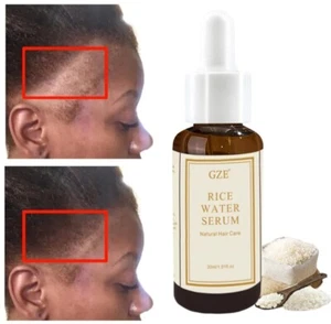 GZE Organic Rice Water Serum for Hair Growth serum for women - Picture 1 of 7