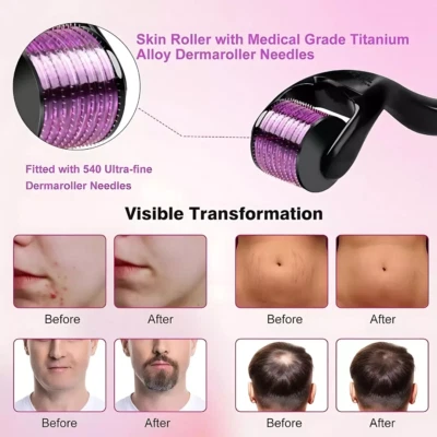 0.5mm 1mm 1.5mm 2.0mm 540 Microneedle Scar Derma Roller Dermaroller - Image 1 of 4