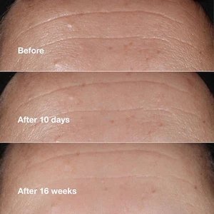 Smart Clinical Repair Wrinkle Correcting Face Serum with Hyaluronic Acid, Pep... - Picture 1 of 12