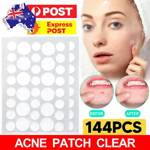 144pcs Skin Tag Remover Patches Quick Effective Mole Wart Removal Pad Sticker AU - Picture 1 of 9