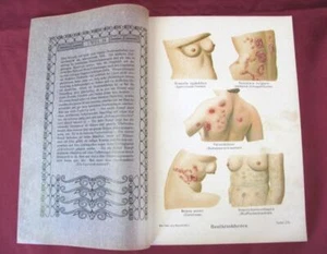1909 ANTIQUE GERMAN ART NOUVEAU MEDICAL COLOR LITHO PRINT – SKIN DISEASES  - Picture 1 of 8