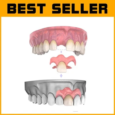 Prótesis dentales removibles de calidad - Elige tu cantidad de dentadura personalizada Foto 1 de 4