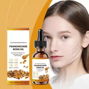 Organic Frankincense Resin Facial Oil - Reduces Fine Lines US 60ml D49C - Picture 1 of 21