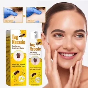Tag Recede Bee Venom Treatment Spray Tag Recede Bee Venom Spray For All Skin - Picture 1 of 11