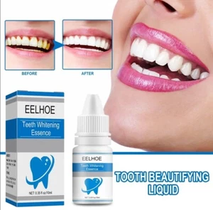Blanqueador de dientes,higiene Oral de limpieza,limpieza Dental, - Picture 1 of 10