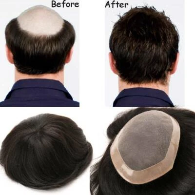 MONO Hombre Toupee Sistema de Repuesto Pelucas Pieza de Cabello Humano Virgen Pieza de Cabello Hombre r Foto 1 de 4
