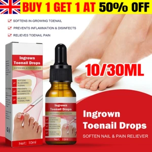 Ingrowth Toenail Correction Treatment Oil Ingrown Toenail Repair Drops UK - Picture 1 of 13