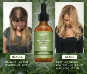Rosemary Oil & Biotin Serum %100Pure For Hair Beard Growth Organic Formula (2oz) - Picture 1 of 10
