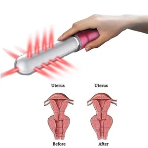 Female Laser Therapy Device for Vaginitis Cervicitis Home Treatment - Picture 1 of 12