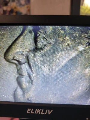 2007 D Roosevelt Dime double Die Chip Error Coin CHIN & Eyebrow - Image 1 of 4